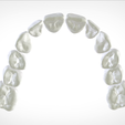Screenshot_11.png Digital Full Dentures for Gluedin Teeth with Manual Reduction