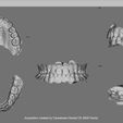 Fraire Uma 2021-04-10 11:46:26 Acquisition created by Carestream Dental CS 3600 Family BOTH MAXILLARS - SUPERIOR and INFERIOR intraoral scan (IOS) - AREA3D - Patient A. Complete DENTURE