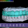 Captura-de-pantalla-7.png bar with overdenture and models