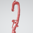 p3.png Case 1 to 6: 3D aortic and iliac artery aneurysm