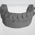 1.png Dental model lower jaw - wax up