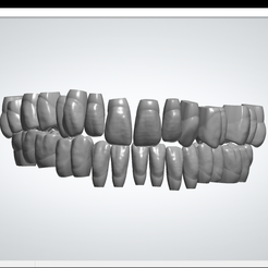 Vertices: 486638 Facets: 973548, 3shape> — 0 (Agate | @rpauus ern weGq STL file Square teeth・Model to download and 3D print