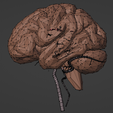 8.png 3D Model of Brain and Blood Supply - Circle of Willis