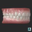 02_MAX.jpg Human teeth with gums