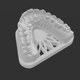 4.png BASES FOR DENTAL 3D PRINTED MODELS - BASES PARA MODELOS ODONTOLÓGICO IMPRESSOS 3D