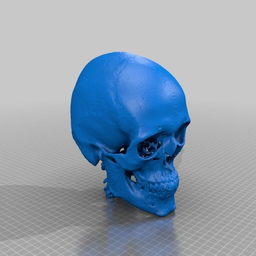db36a43b90b2add37426b86491746403.png Anonymous CT Skull 3
