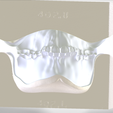 4.png Digital Try-in Full Dentures for Injection Molding