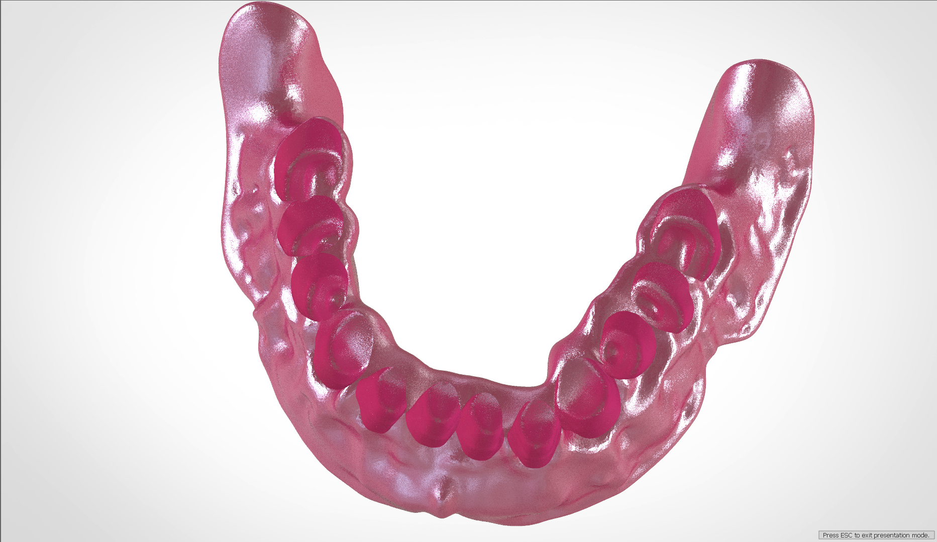 Screenshot_7.png Download OBJ file Digital Full Dentures for Gluedin Teeth with Manual Reduction • 3D printable design, LabMagic3DCAD
