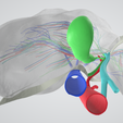 fibrotic-LIVER,-abdominal,-abdomen,-spleen,-pancreas,-pancreatic,-biliary,-hepatic,-artery,-vein,-po.png 6 PIÈCES Modèle 3D réaliste du foie atteint de cirrhose (fibrose) - avec système biliaire, veines portales, veines et artères hépatiques, ligaments du foie