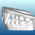VTside.png Vampire Teeth Dental Model for Halloween (2 piece - No Supports)