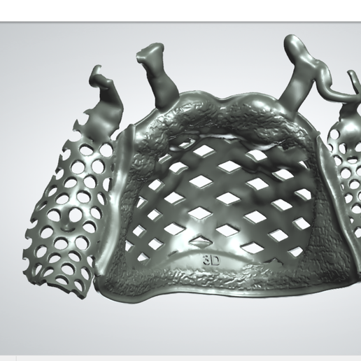 🖼️ Digital RPD Frame (Partial Denture)・ STL File for ・Cults