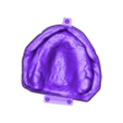 789513050_20250505_0858_Tech_01_OM3_H_total_a_D_Flex_UnsectionedModel_UpperJaw.stl TOTAL REMOVABLE DENTURE upper + FLEXI PARTIAL DENTURE lower ( total 11 stl files)