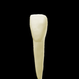 11.png Left Lower Lateral Lateral Incisor #32