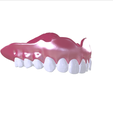 18.png Digital Full Dentures with Combined Glue-in Teeth Arch