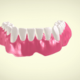 Screenshot_12.png Full Dentures with Many Production Options