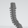 Spine1.png SCOLIOSIS HUMAN VERTEBRAE SPINE / ANATOMY / EDUCATION PURPOSE