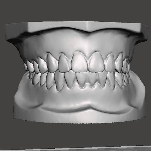 🦷 complete upper dental model in lower teeth teeth・ STL File for 3D ...