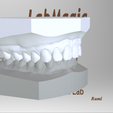 Screenshot_8.png Digital Orthodontic Study Models with Virtual Bases