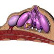 BREAST-03.JPG Anatomical female breasts model with common diseases