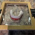 IMG_1224.jpg Free STL file Pro-Form Dental Vacuum Forming Box・Template to download and 3D print