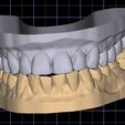 WhatsApp-Image-2024-04-14-at-11.54.27.jpeg Digital dental model for practice