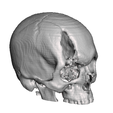 Captura-de-Pantalla-2023-08-22-a-la-s-6.34.09-p. m.png skull fracture / skull fracture