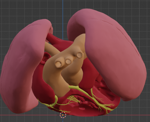 1.png 3D Model of Transposition of the Great Arteries Open Duct