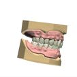 digital-full-dentures-3d-model-stl.png.jpg STL file Digital Full Dentures・3D printer model to download