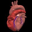 2.jpg 3D Model of Heart with Atrial Septal Defect