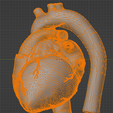 13.png 3D Heart Anatomy with Codominance