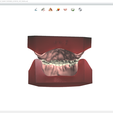 Screenshot_9.png Digital Try-in Full Dentures for Injection Molding