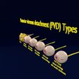 posterior-vitreous-detachment-types-eye-3d-model-blend-91.jpg Posterior vitreous detachment types eye 3D model