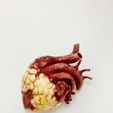 2023-01-23-16.05.26.jpg Anatomical model of obese heart