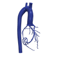6.png 3D Model of Aorta and Coronary Arteries