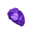 STL00001.stl 3D Model of Human Heart with Transposition of Great Arteries (TGA) - generated from real patient