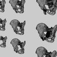pelvis-fracture-classifications-3d-model-blend-44.jpg Pelvis fracture classifications 3D model